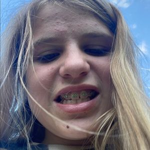 Meet your Posher, Allie